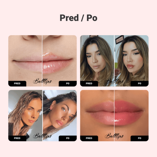 Zázvorová & Mätová BULKLIPS sada na zväčšenie pier - Image 2