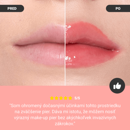 Zázvorová & Mätová BULKLIPS sada na zväčšenie pier - Image 5