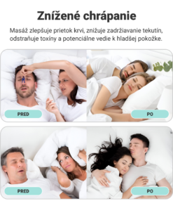 Alternative view of Silikónová magnetická spona proti chrápaniu