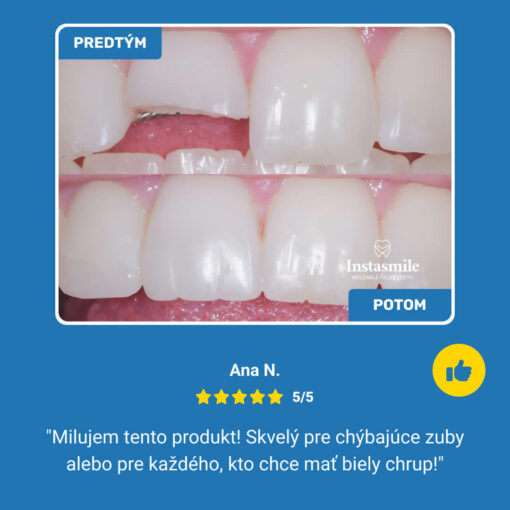 INSTASMILE REPARAČNÝ KIT NA ZUBY - Image 7