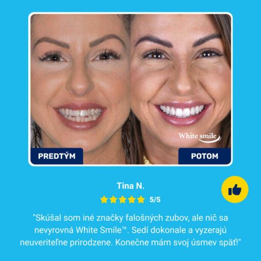 Realisticky vyzerajúce falošné zuby: WhiteSmile - Image 7