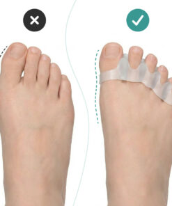 Alternative view of OrthoRelax® – Gélový oddeľovač prstov (2 oddeľovače)